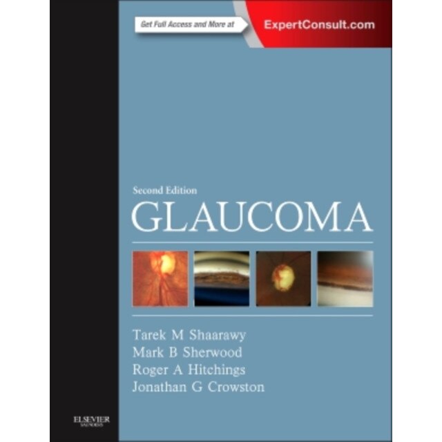 Glaucoma de Tarek M. Shaarawy