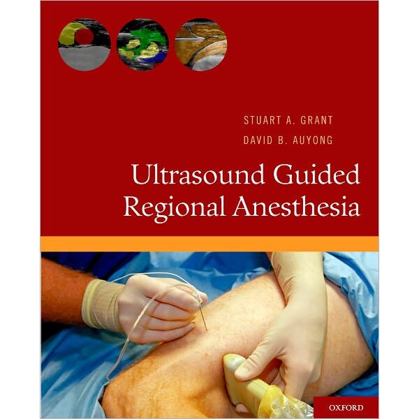 Ultrasound Guided Regional Anesthesia de Stuart A. Grant