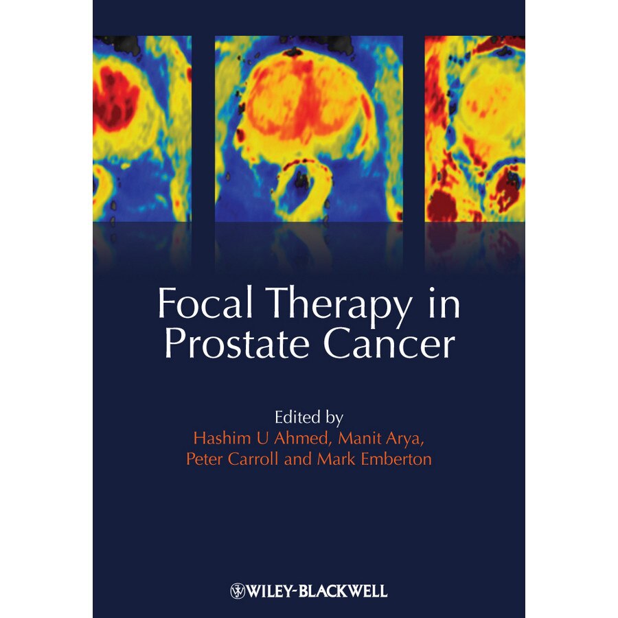 Focal Therapy in Prostate Cancer de Hashim Uddin Ahmed