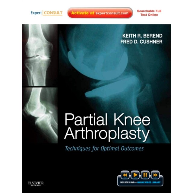 Partial Knee Arthroplasty de Keith R. Berend