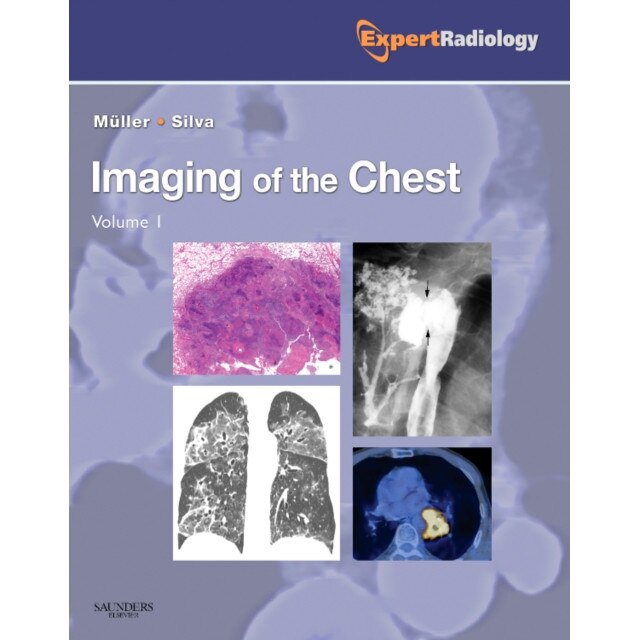 Imaging of the Chest, 2-Volume Set de Nestor L. Muller