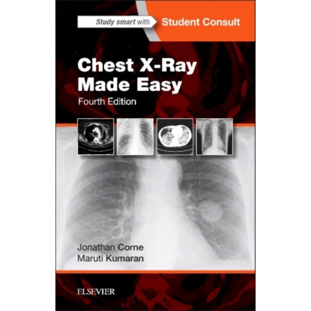 Chest X-Ray Made Easy de Jonathan Corne