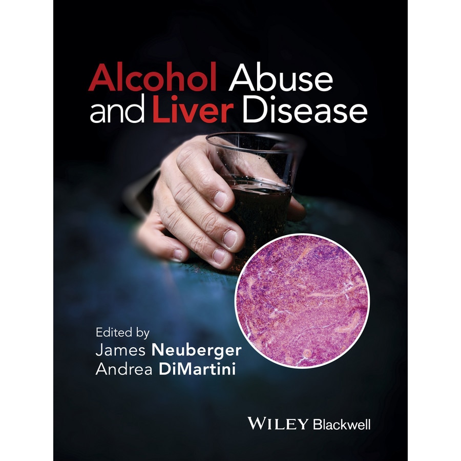 Alcohol Abuse and Liver Disease de James Neuberger
