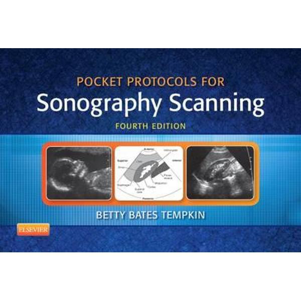 Pocket Protocols for Sonography Scanning