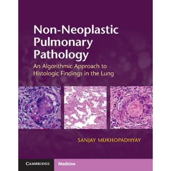 Non-Neoplastic Pulmonary Pathology with Online Resource