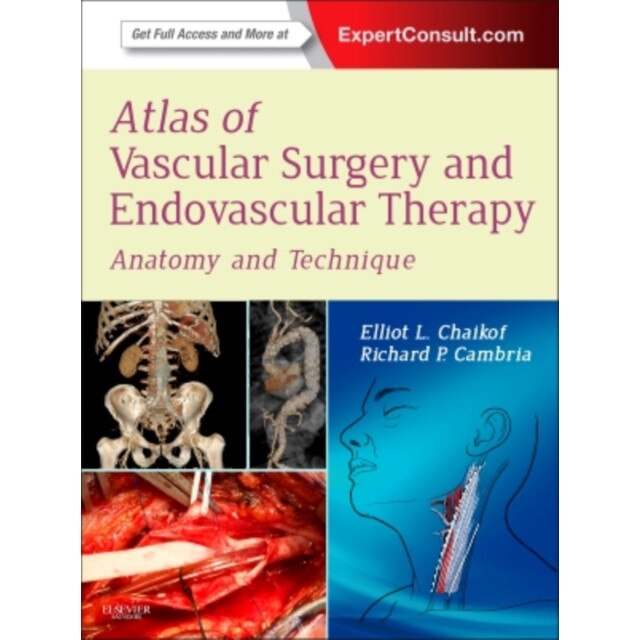 Atlas of Vascular Surgery and Endovascular Therapy de Elliot L. Chaikof