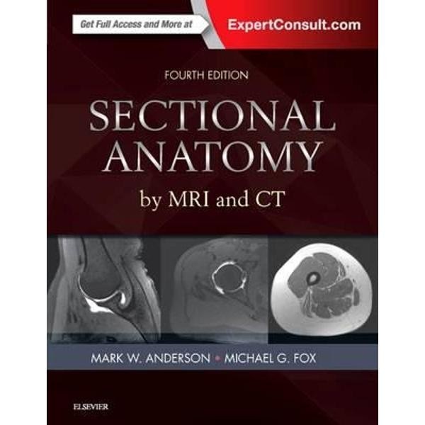 Sectional Anatomy by MRI and CT