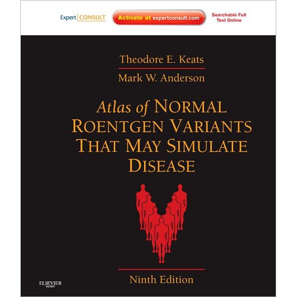 Atlas of Normal Roentgen Variants That May Simulate Disease de Theodore E. Keats