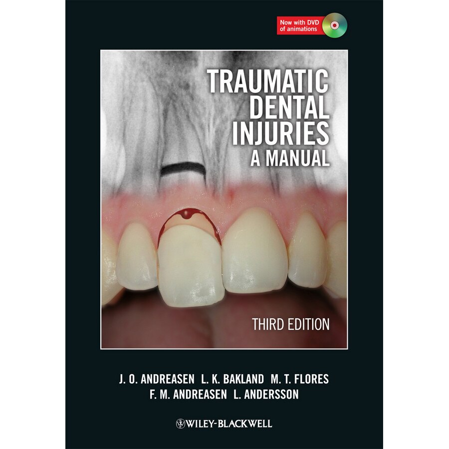 Traumatic Dental Injuries de Jens O. Andreasen