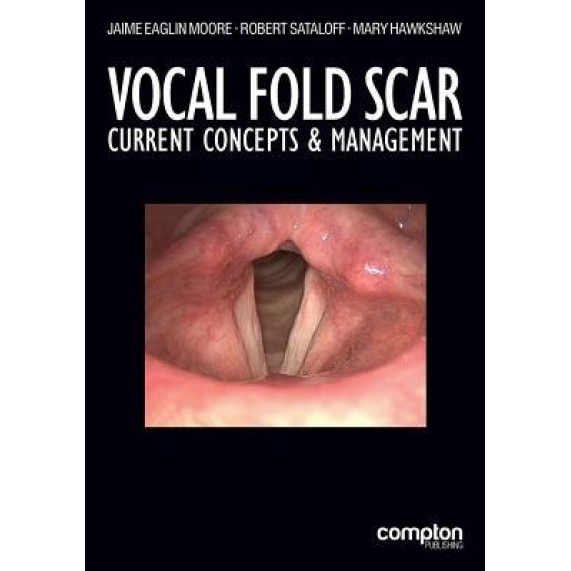 Vocal Fold Scar: Current Concepts and Management - Jaime Eaglin Moore (Editor)