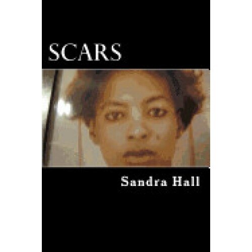Scars