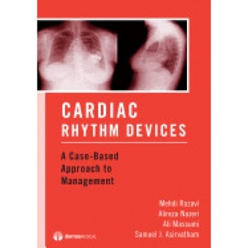 Cardiac Rhythm Devices: A Case-Based Approach to Management Cardiac Rhythm Devices: A Case-Based Approach to Management