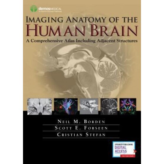 Imaging Anatomy of the Human Brain: A Comprehensive Atlas Including Adjacent Structures - Neil M. Borden (Author)