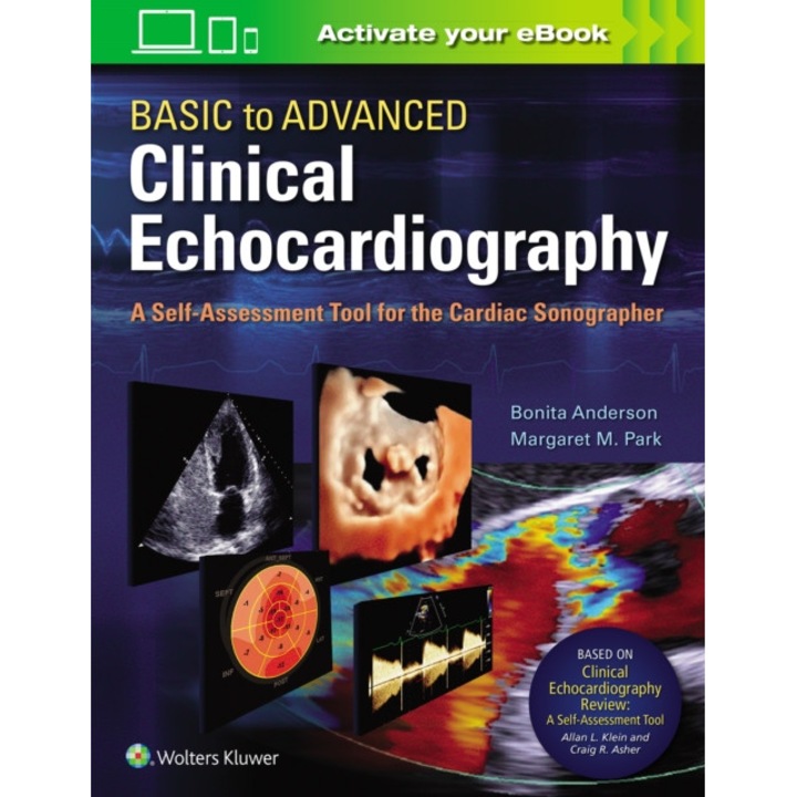 Basic to Advanced Clinical Echocardiography de Bonita Anderson