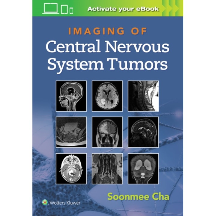Imaging of Central Nervous System Tumors de Dr. Soonme Cha