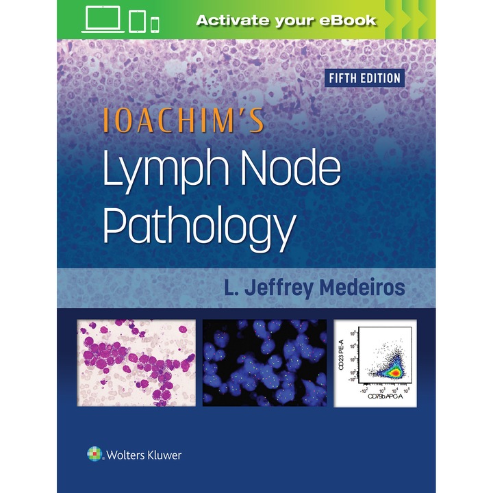 Ioachim's Lymph Node Pathology de L. Jeffrey Medeiros
