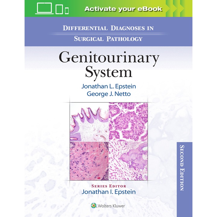 Differential Diagnoses in Surgical Pathology: Genitourinary System de Jonathan Epstein MD