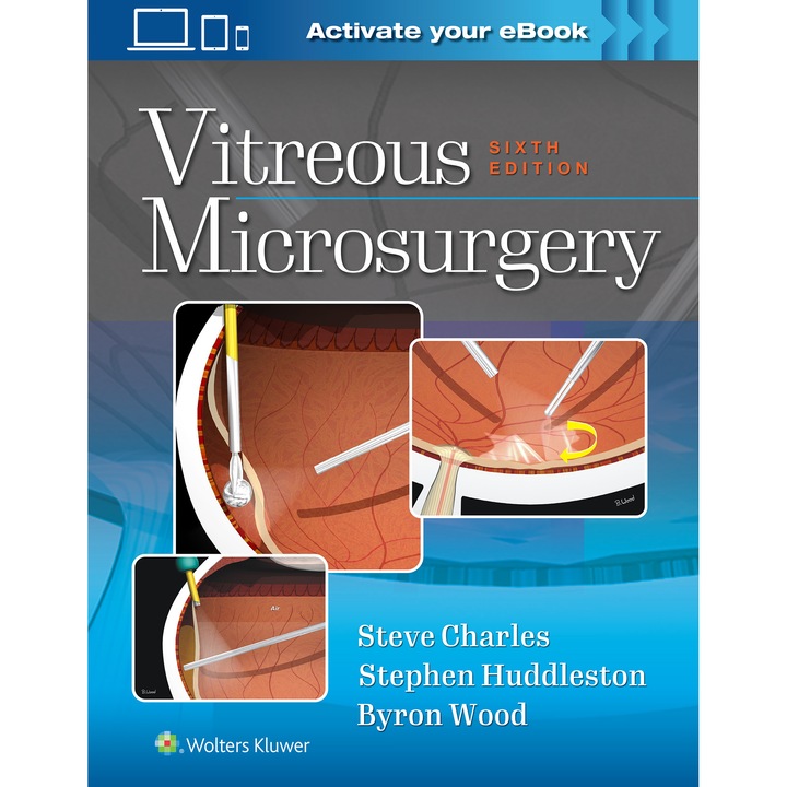 Vitreous Microsurgery de Steve Charles MD