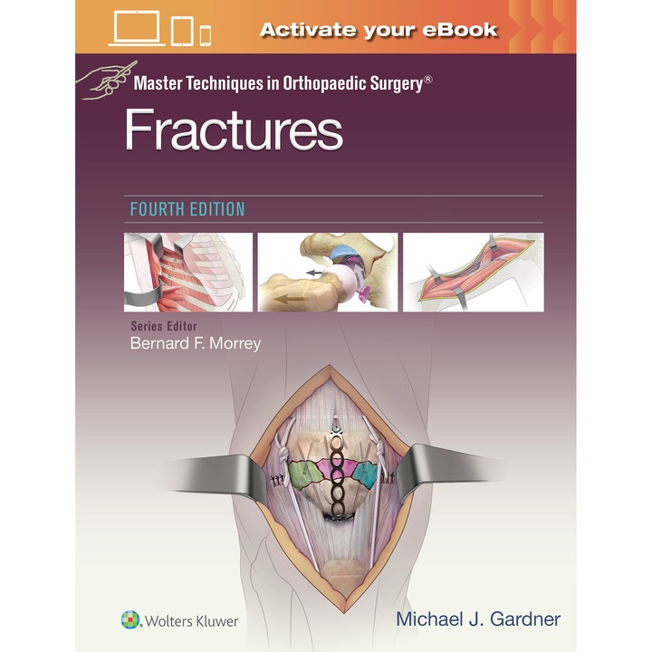 Master Techniques in Orthopaedic Surgery: Fractures de Michael J. Gardner MD