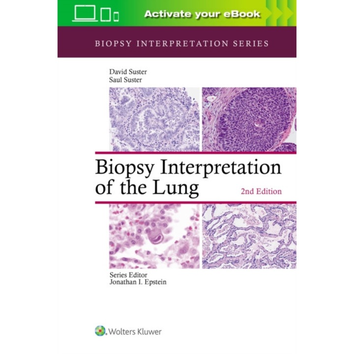 Biopsy Interpretation of the Lung de Saul Suster MD