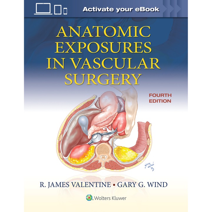 Anatomic Exposures in Vascular Surgery de R. James Valentine MD, FACS
