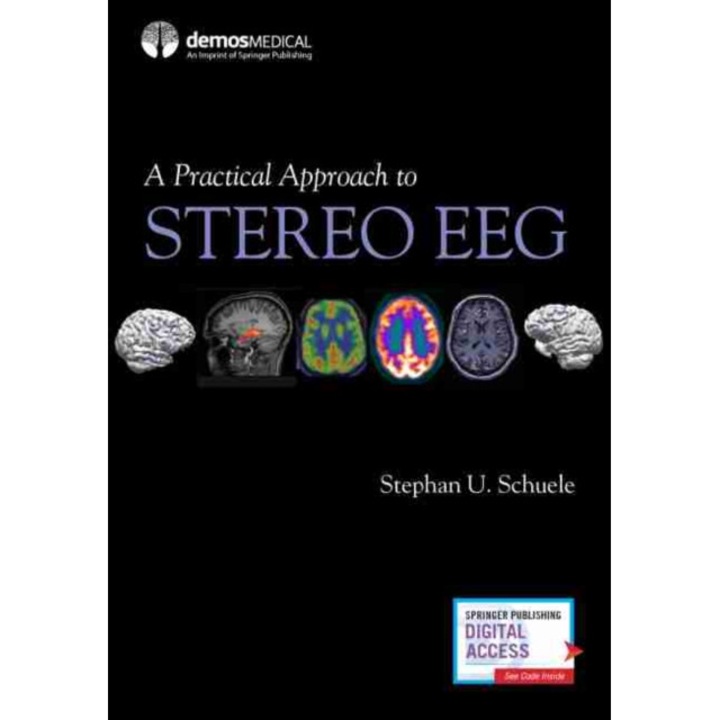 A Practical Approach to Stereo Eeg de Stephan Schuele