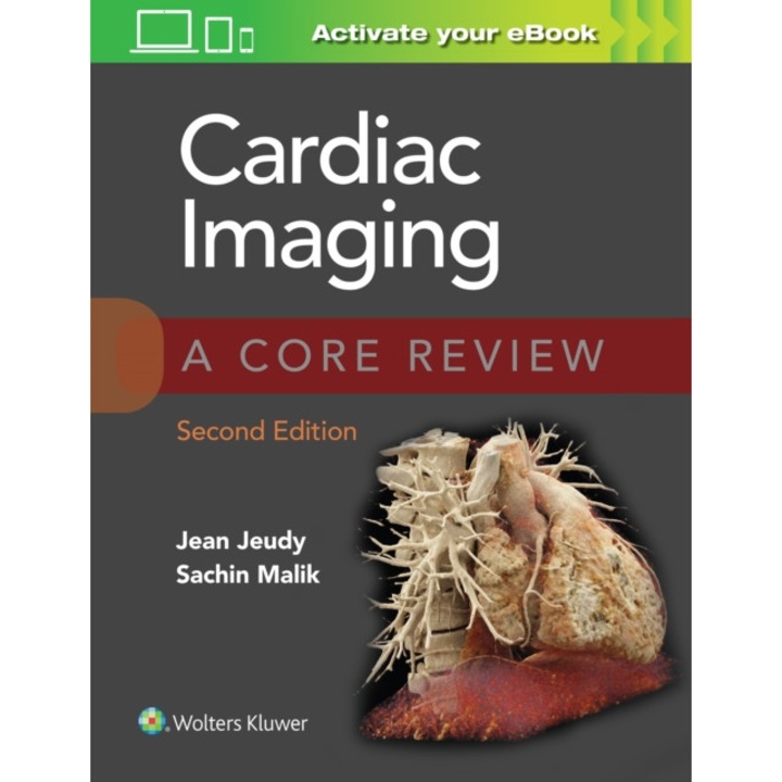 Cardiac Imaging: A Core Review de Jean Jeudy