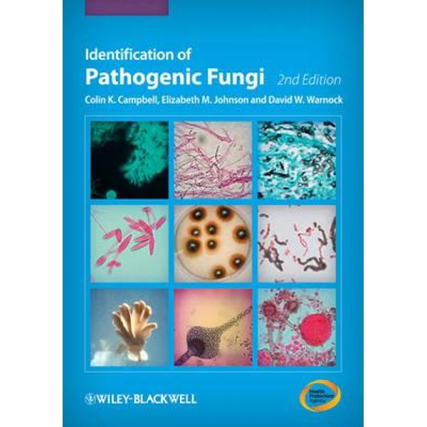 Identification of Pathogenic Fungi