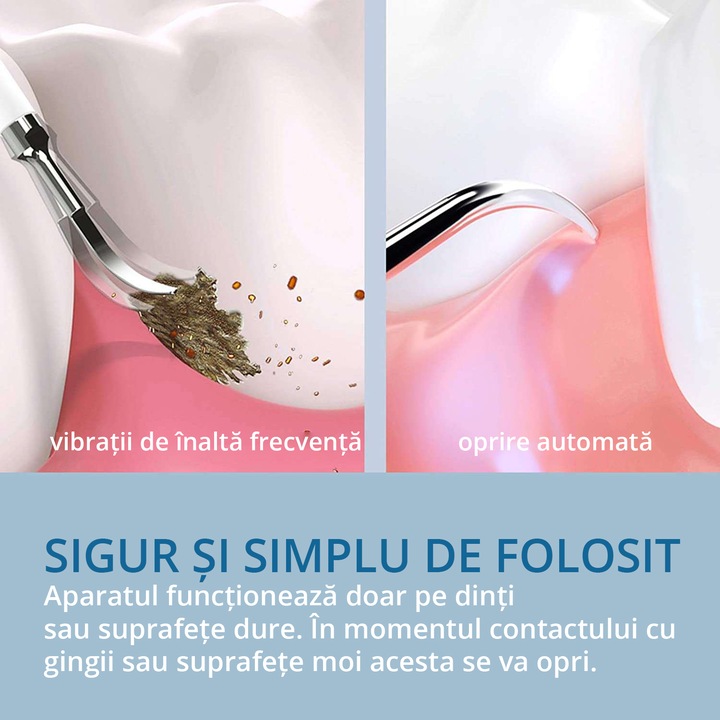 Dispozitiv pentru eliminare tartru, Zenkabeat Smart Sonic Pro, 5 moduri de lucru, Detartraj Ultrasonic, Rezistent la Apa, Baterie Reincarcabila, Negru