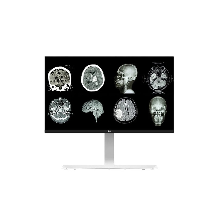 LG 27HJ712C-W Clinical Review LED Monitor 27", 8 MP felbontású IPS, 14ms, UHD, HDMI, Displayport, Ezüst
