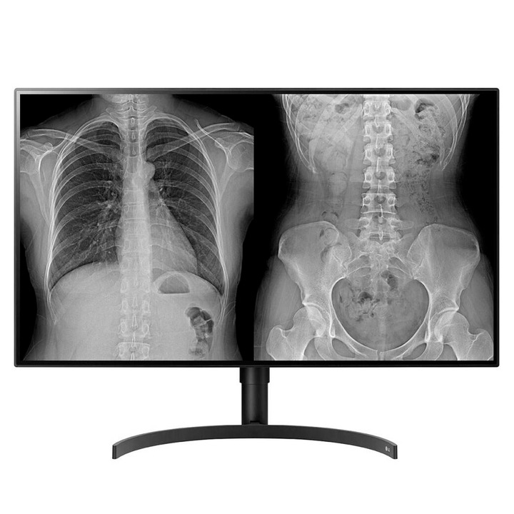 LG 32HL512D-B Diagnostic Monitor 31,5", 8MP IPS, UHD, 14ms, USB, HDMI, DP, fekete