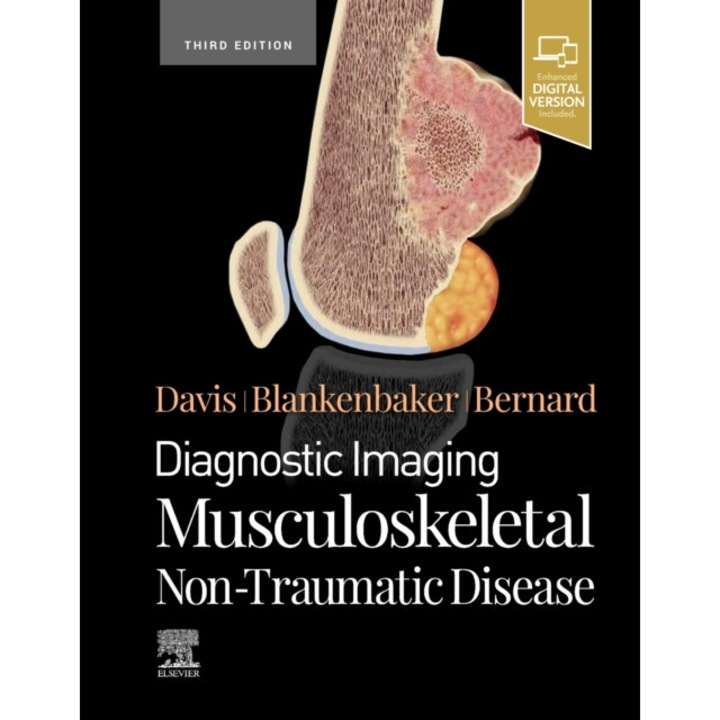 Diagnostic Imaging: Musculoskeletal Non-Traumatic Disease de Kirkland W. Davis