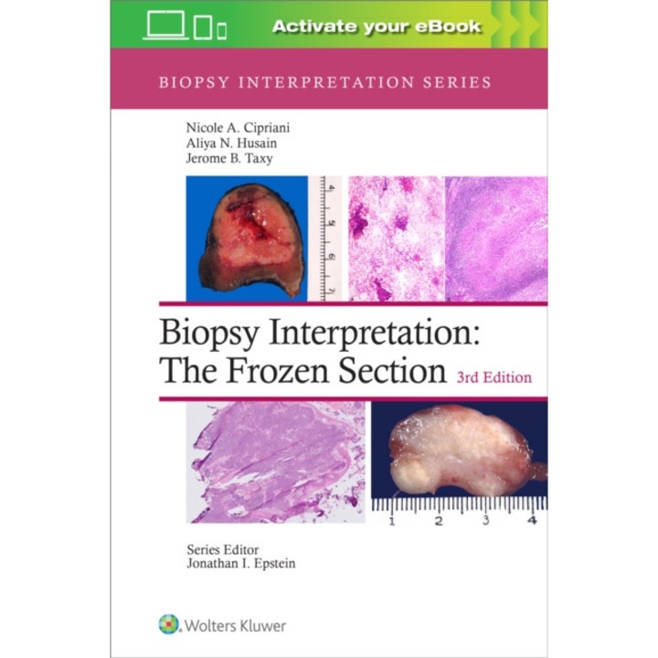 Biopsy Interpretation: The Frozen Section de Nicole A. Cipriani MD