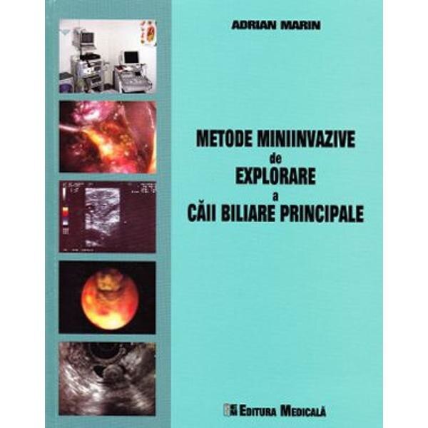 Metode miniinvazive de explorare a caii biliare principale - Adrian Marin