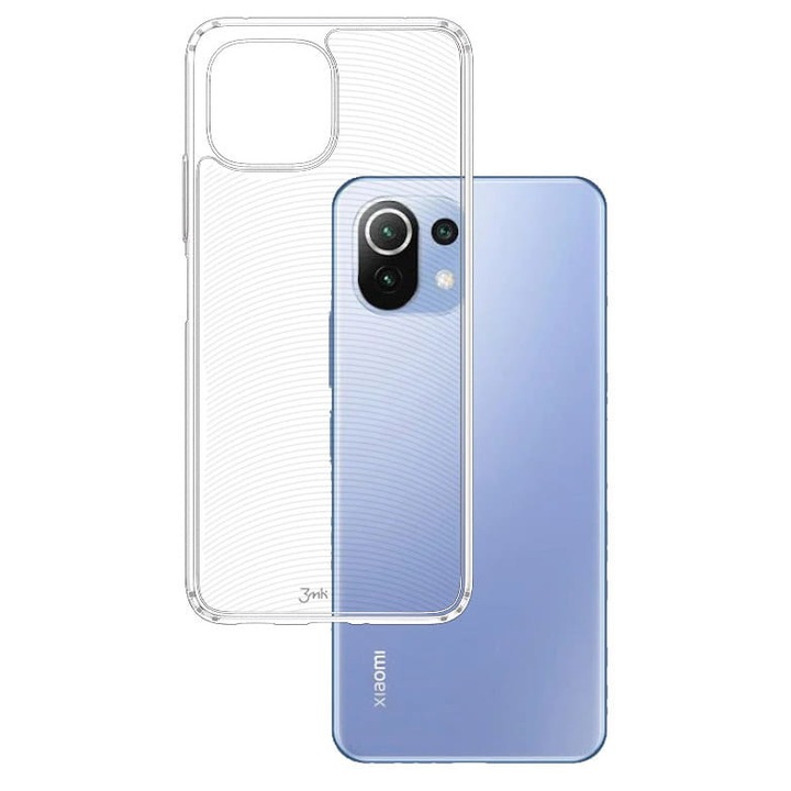 Védő telefontok, 2MK, Xiaomi Mi 11 Lite / 5G / 5G NE, Átlátszó