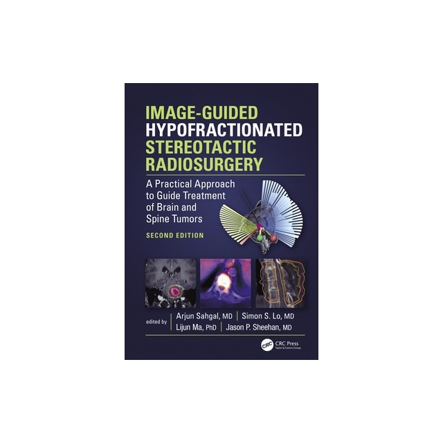 ImageGuided Hypofractionated Stereotactic Radiosurgery A Practical