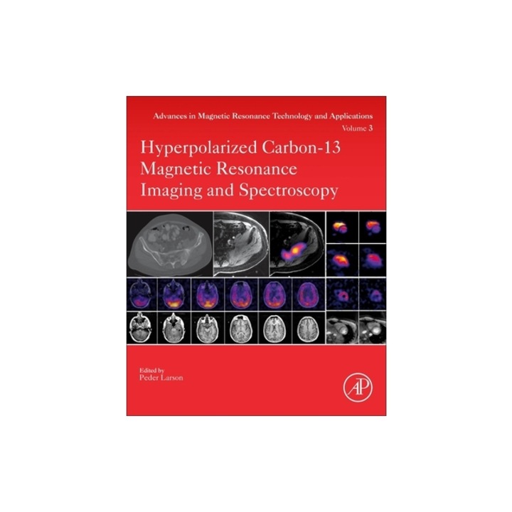 Hyperpolarized Carbon-13 Magnetic Resonance Imaging and Spectroscopy, Peder Larson