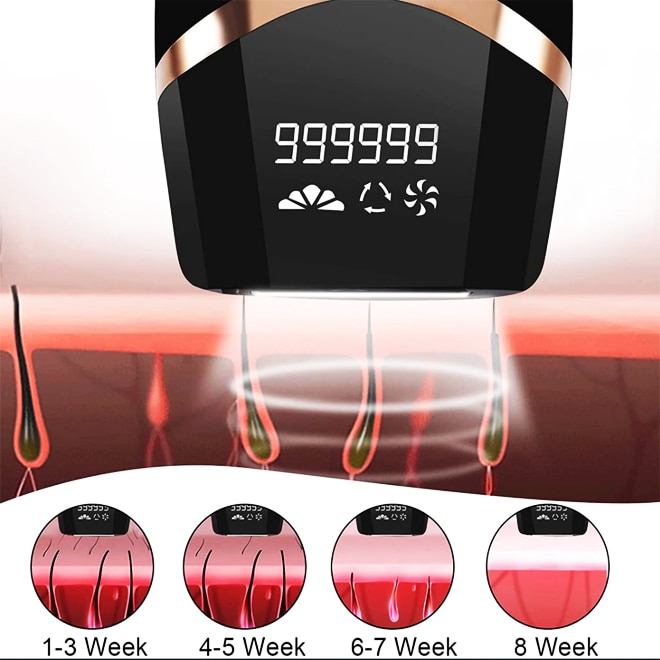 Epilator laser IPL, clasa Premium, 990.000 pulsatii, epilare definitiva