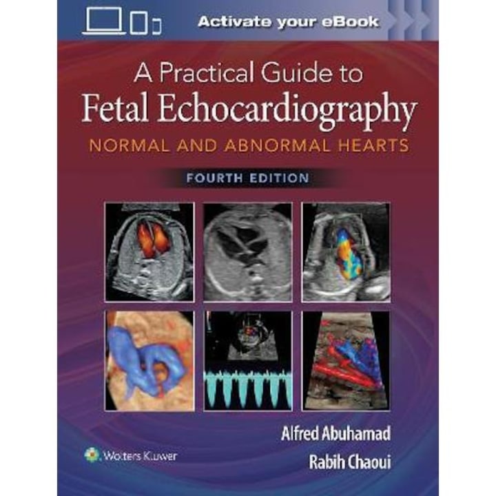 A Practical Guide To Fetal Echocardiography: Normal And Abnormal Hearts - Alfred Z. Abuhamad