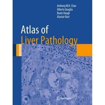 Atlas of Liver Pathology Atlas of Liver Pathology