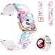 BEST ACCESSORIES Szíj, Amazfit GTS, GTS 2, GTS 3, GTS 4, MINI, Amazfit BIP, Garmin Venu, Vivoactive 3, Samsung Galaxy Watch 4 40/42/44/46mm, Samsung Galaxy Watch 5 40/44/45mm, Huawei Watch GT 2 készülékekhez, 42mm, GT 3 42mm, elegáns, 20mm, pillangó minta