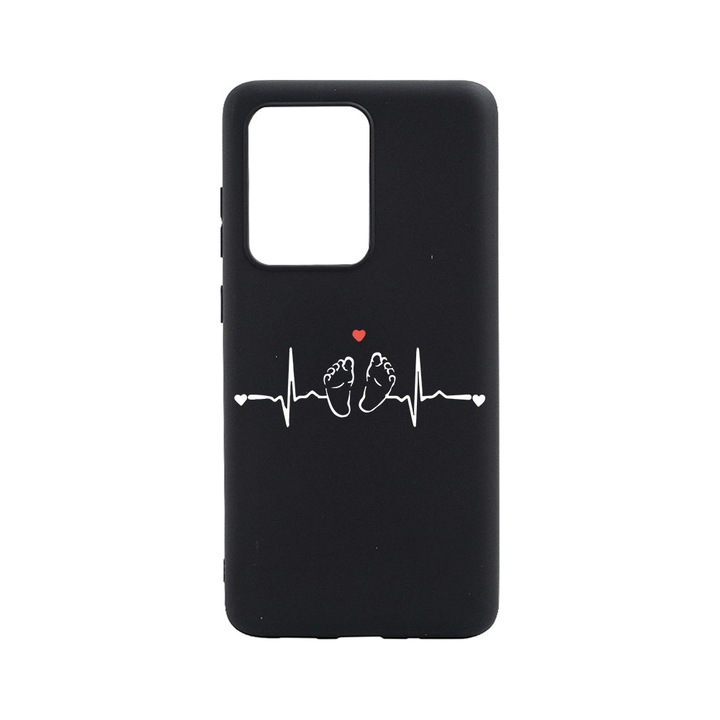 BestCase Slim Szilikon 0.8MM telefontok, Huawei P40, My Little Love, B 966