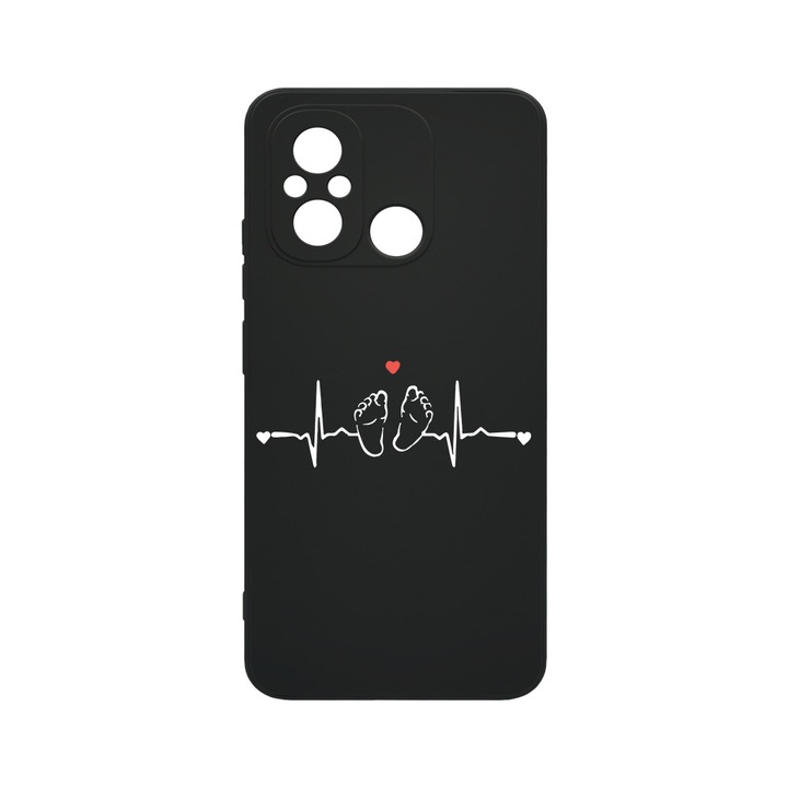 Husa BestCase® SLIM SIlicon 0.8MM, Compatibila Cu Xiaomi Redmi 12C, My Little Love, Rezistenta la uzura, Protectie Camera, c-B 966