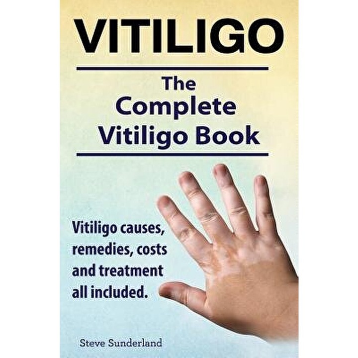 Vitiligo. Vitiligo Causes, Remedies, Costs and Treatment All Included. the Complete Vitiligo Book., Paperback - Steve Sunderland