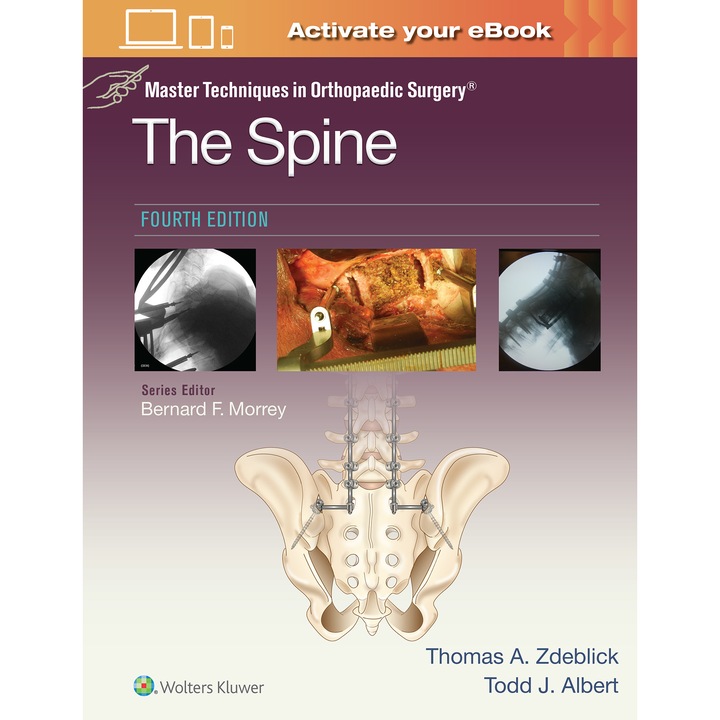 Master Techniques in Orthopaedic Surgery: The Spine de Todd Albert MD