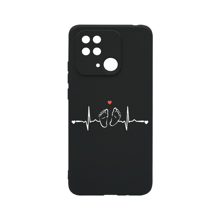 BestCase Slim Silicon 0.8MM telefontok, Xiaomi Poco C40, My Little Love, Kamera védő, c-B 966