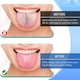 Set 6 dispozitiv de curatare limba, Ronyes®, Eliminare respiratie urata, Multicolor