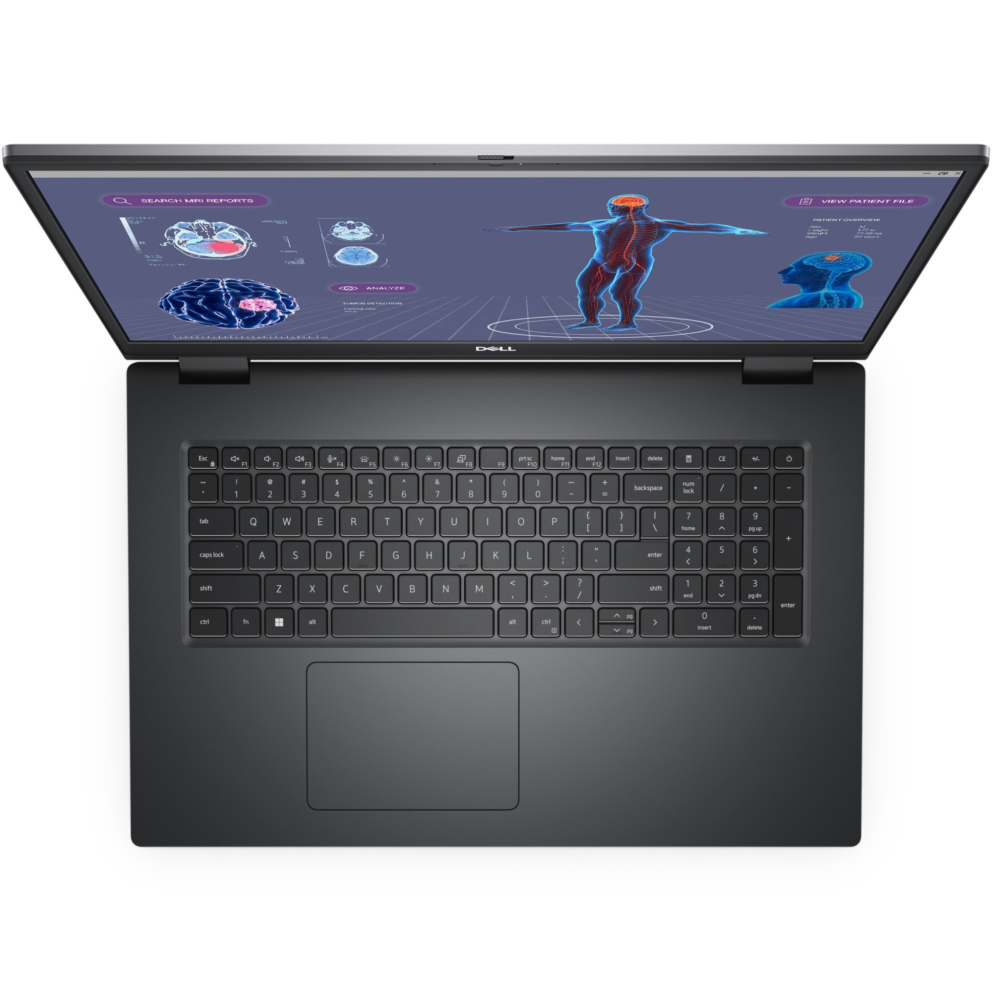Laptop Dell Precision 7780, 17