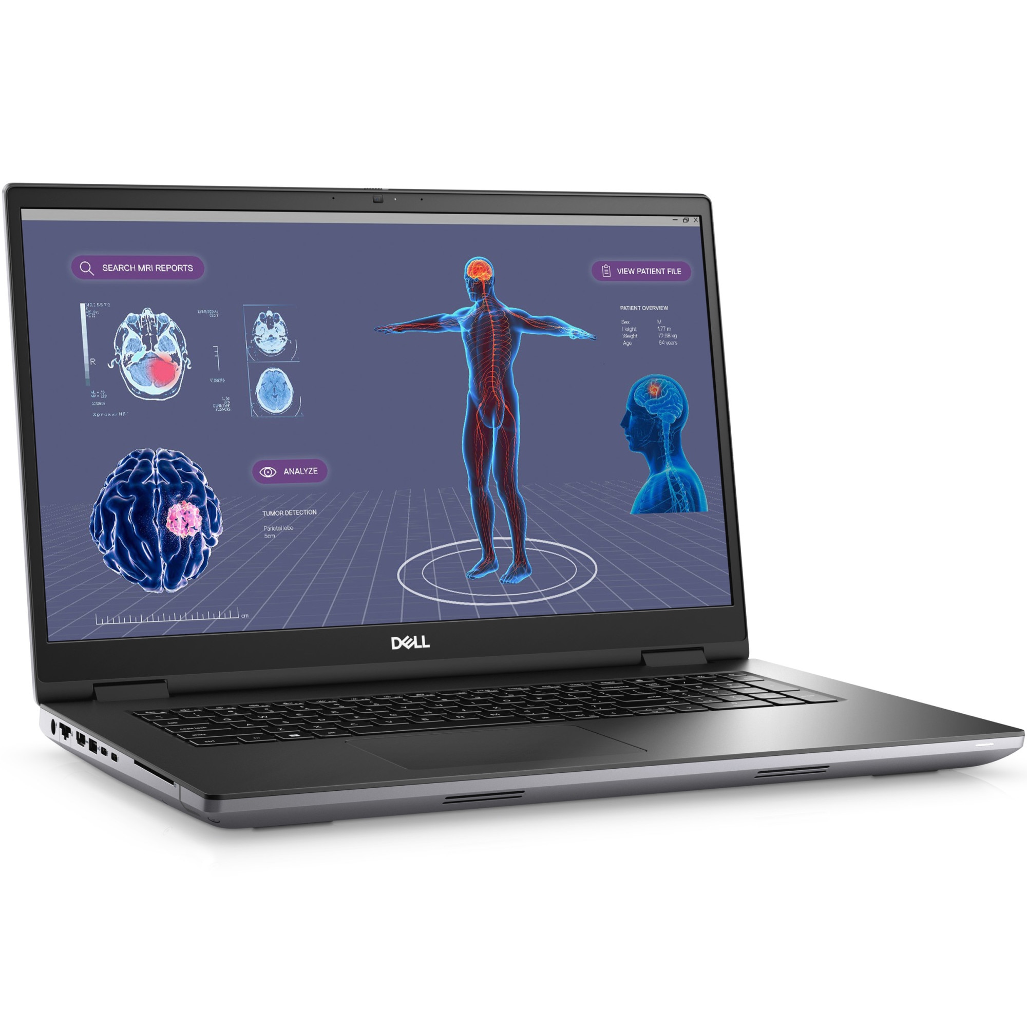 Laptop Dell Precision 7780, 17