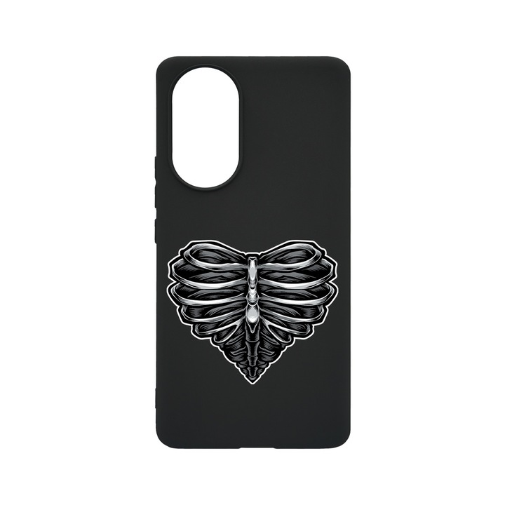 BestCase Slim Szilikon 0.8MM telefontok, Huawei Nova 9, Skeleton Heart, B 1024